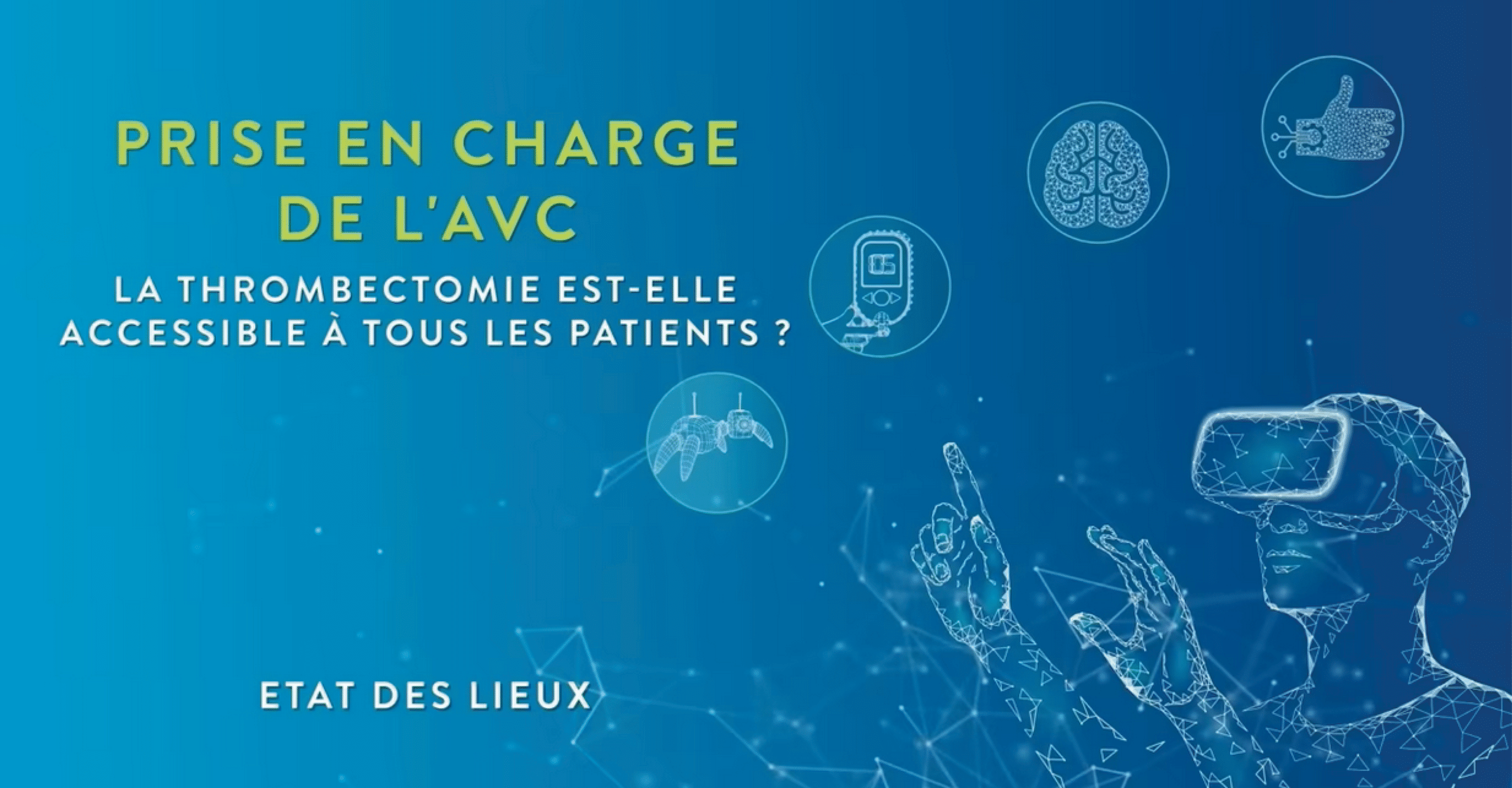 Prise en charge de l'AVC - Thrombectomie - Etat des lieux