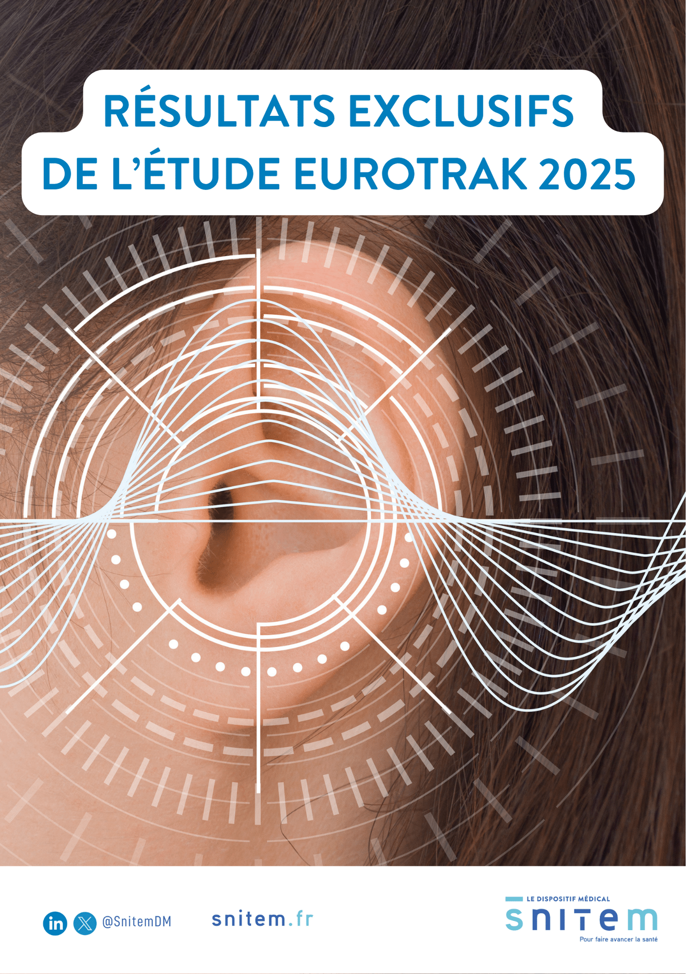 Etude EuroTrak